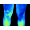 fluke_ti400_humanthermografie_beine_1103875028