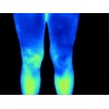 fluke_tis65_humanthermografie_beine_1740852854
